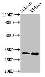 Western Blot | Positive WB detected in: Mouse spleen tissue, Mouse kidney tissue | All lanes: ABT1 antibody at 3μg/ml | Secondary | Goat polyclonal to rabbit IgG at 1/50000 dilution | Predicted band size: 32 kDa | Observed band size: 32 kDa