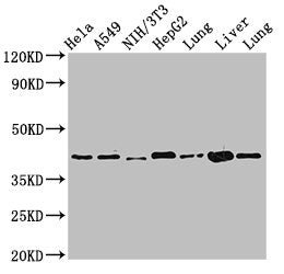 Western Blot  | Positive WB detected in: Hela whole cell lysate, A549 whole cell lysate, NIH/3T3 whole cell lysate, HepG2 whole cell lysate, Rat lung tissue, Mouse liver tissue, Mouse lung tissue  | All lanes: ACAA2 antibody at 2.4μg/ml  | Secondary  | Goat polyclonal to rabbit IgG at 1/50000 dilution  | Predicted band size: 42 kDa  | Observed band size: 42 kDa