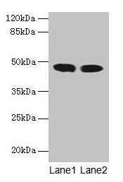 Western blot  | All lanes: ACADL antibody at 8µg/ml  | Lane 1: Mouse kidney tissue  | Lane 2: Mouse heart tissue  | Secondary  | Goat polyclonal to rabbit IgG at 1/10000 dilution  | Predicted band size: 48 kDa  | Observed band size: 48 kDa