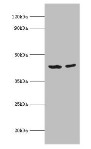 Western blot | All lanes: Short-chain specific acyl-CoA dehydrogenase, mitochondrial antibody at 7μg/ml | Lane 1: 293T whole cell lysate | Lane 2: HepG2 whole cell lysate | Secondary | Goat polyclonal to rabbit IgG at 1/10000 dilution | Predicted band size: 44 kDa | Observed band size: 44 kDa