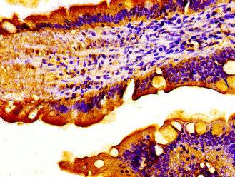 Immunohistochemistry of paraffin-embedded human small intestine tissue using ACADVL Antibody at dilution of 1:100
