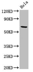 Western Blot | Positive WB detected in: Hela whole cell lysate | All lanes: ACADVL antibody at 2μg/ml | Secondary | Goat polyclonal to rabbit IgG at 1/50000 dilution | Predicted band size: 71, 69, 73 kDa | Observed band size: 71 kDa
