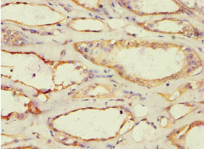 Immunohistochemistry of paraffin-embedded human kidney tissue using ACAT1 Antibody at dilution of 1:100