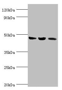 Western blot  | All lanes: ACAT1 antibody at 6µg/ml  | Lane 1: Mouse skeletal musce tissue  | Lane 2: Rat heart tissue  | Lane 3: THP-1 whole cell lysate  | Secondary  | Goat polyclonal to rabbit IgG at 1/10000 dilution  | Predicted band size: 46, 18 kDa  | Observed band size: 46 kDa