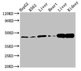 Western Blot  | Positive WB detected in: HepG2 whole cell lysate, K562 whole cell lysate, Rat liver tissue, Mouse heart tissue, Mouse liver tissue Mouse kindey tissue  | All lanes: ACAT1 antibody at 3µg/ml  | Secondary  | Goat polyclonal to rabbit IgG at 1/50000 dilution  | Predicted band size: 46, 18 kDa  | Observed band size: 46 kDa