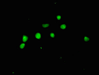 Immunofluorescent analysis of HepG2 cells using ACLY Antibody at dilution of 1:100 and Alexa Fluor 488-congugated AffiniPure Goat Anti-Rabbit IgG(H+L)