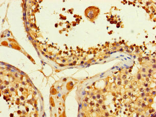 Immunohistochemistry of paraffin-embedded human testis tissue using ACLY Antibody at dilution of 1:100