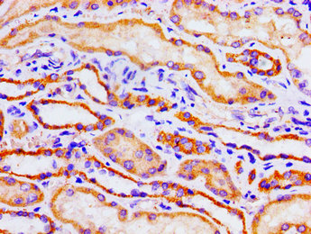 Immunohistochemistry of paraffin-embedded human kidney tissue using ACO1 Antibody at dilution of 1:100