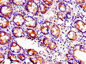 Immunohistochemistry of paraffin-embedded human small intestine tissue using ACO1 Antibody at dilution of 1:100
