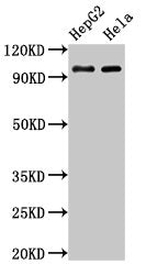 Western Blot  | Positive WB detected in: HepG2 whole cell lysate, Hela whole cell lysate  | All lanes: ACO1 antibody at 3µg/ml  | Secondary  | Goat polyclonal to rabbit IgG at 1/50000 dilution  | Predicted band size: 99 kDa  | Observed band size: 99 kDa