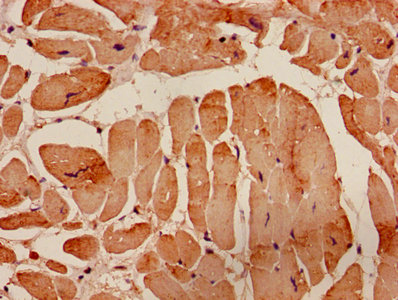 Immunohistochemistry of paraffin-embedded human heart tissue using ACTA1 Antibody at dilution of 1:100