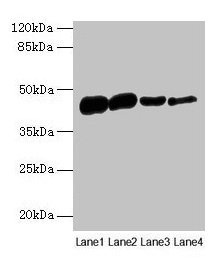 Western blot  | All lanes: ACTA1 antibody at 16µg/ml  | Lane 1: Rat heart tissue  | Lane 2: Mouse skeletal muscle tissue  | Lane 3: Human placenta tissue  | Lane 4: CEM whole cell lysate  | Secondary  | Goat polyclonal to rabbit IgG at 1/10000 dilution  | Predicted band size: 43 kDa  | Observed band size: 43 kDa