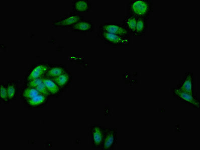 Immunofluorescent analysis of HepG2 cells using ACTB Antibody at dilution of 1:100 and Alexa Fluor 488-congugated AffiniPure Goat Anti-Rabbit IgG(H+L)