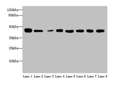 Western blot | All lanes: ACTL6A antibody at 4 μg/ml | Lane 1: Mouse thymus tissue | Lane 2: Mouse spleen tissue | Lane 3: Mouse heart tissue | Lane 4: Jurkats whole cell lysate | Lane 5: K562 whole cell lysate | Lane 6: Hela whole cell lysate | Lane 7: A549 whole cell lysate | Lane 8: MCF-7 whole cell lysate | Secondary | Goat polyclonal to rabbit IgG at 1/10000 dilution | Predicted band size: 48, 44 kDa | Observed band size: 48 kDa
