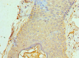 Immunohistochemistry of paraffin-embedded human skin tissue using ACTL6B Antibody at dilution of 1:100