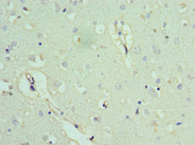 Immunohistochemistry of paraffin-embedded human brain tissue using ACTL6B Antibody at dilution of 1:100