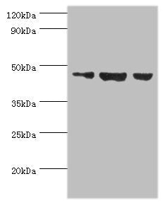 Western blot | All lanes: Actin-like protein 6B antibody at 3μg/ml | Lane 1: Hela whole cell lysate | Lane 2: U251 whole cell lysate | Lane 3: HepG2 whole cell lysate | Secondary | Goat polyclonal to rabbit IgG at 1/10000 dilution | Predicted band size: 47 kDa | Observed band size: 47 kDa