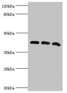 Western blot | All lanes: Alpha-centractin antibody at 8μg/ml | Lane 1: Mouse brain tissue | Lane 2: MCF-7 whole cell lysate | Lane 3: Mouse liver tissue | Secondary | Goat polyclonal to rabbit IgG at 1/10000 dilution | Predicted band size: 43 kDa | Observed band size: 43 kDa