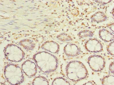 Immunohistochemistry of paraffin-embedded human colon tissue using the antibody at dilution of 1:100