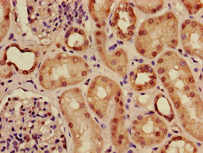 Immunohistochemistry of paraffin-embedded human kidney tissue using ACTRT1 Antibody at dilution of 1:100Rabbit anti-Human ACTRT1 Polyclonal Antibody