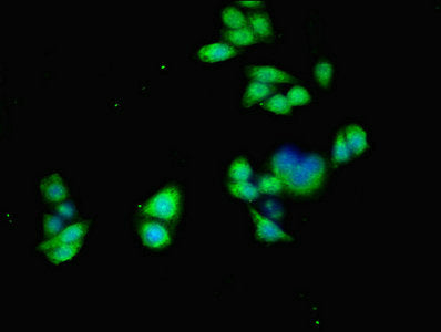 Immunofluorescent analysis of PC-3 cells using ACVR1 Antibody at dilution of 1:100 and Alexa Fluor 488-congugated AffiniPure Goat Anti-Rabbit IgG(H+L)