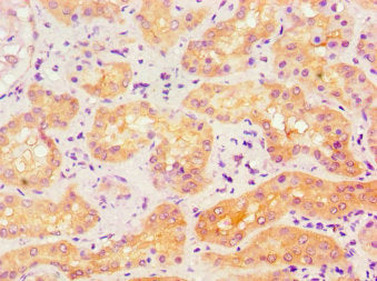 Immunohistochemistry of paraffin-embedded human kidney tissue using ACVR1 Antibody at dilution of 1:100