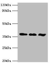 Western blot | All lanes: ACVR1 antibody at 6μg/ml | Lane 1: A549 whole cell lysate | Lane 2: HepG2 whole cell lysate | Lane 3: Mouse gonad tissue | Secondary | Goat polyclonal to rabbit IgG at 1/10000 dilution | Predicted band size: 39 kDa | Observed band size: 39 kDa
