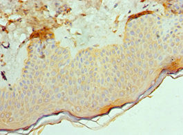 Immunohistochemistry of paraffin-embedded human skin tissue using ACVR2A Antibody at dilution of 1:100Rabbit anti-Human ACVR2A Polyclonal Antibody