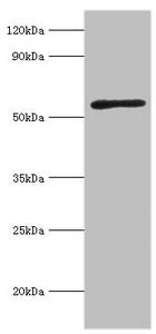 Western blot | All lanes: Activin receptor type-2A antibody at 3μg/ml + Mouse brain tissue | Secondary | Goat polyclonal to rabbit IgG at 1/10000 dilution | Predicted band size: 58, 46 kDa | Observed band size: 58 kDa