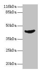 Western blot  | All lanes: ADA antibody at 2µg/ml + Jurkat whole cell lysate  | Secondary  | Goat polyclonal to rabbit IgG at 1/10000 dilution  | Predicted band size: 41 kDa  | Observed band size: 41 kDa
