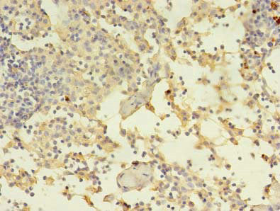 Immunohistochemistry of paraffin-embedded human thymus tissue using ADAM10 Antibody at dilution of 1:100