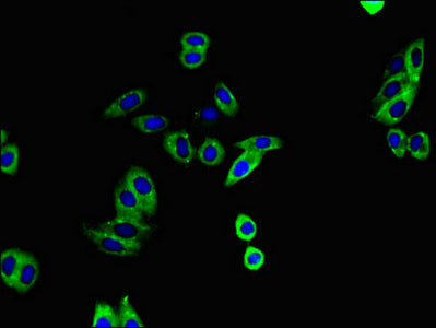Immunofluorescent analysis of HepG2 cells using ADAM12 Antibody at dilution of 1:100 and Alexa Fluor 488-congugated AffiniPure Goat Anti-Rabbit IgG(H+L)