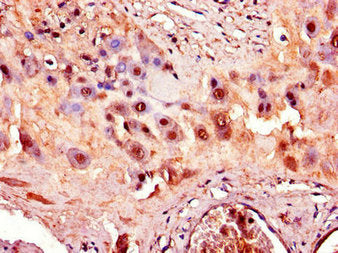 Immunohistochemistry of paraffin-embedded human placenta tissue using the antibody at dilution of 1:100