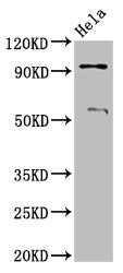 Western Blot  | Positive WB detected in: Hela whole cell lysate  | All lanes: ADAM23 antibody at 3.2µg/ml  | Secondary  | Goat polyclonal to rabbit IgG at 1/50000 dilution  | Predicted band size: 92, 93 kDa  | Observed band size: 92 kDa