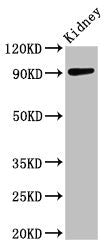 Western Blot  | Positive WB detected in: Mouse kidney tissue  | All lanes: ADAMTS4 antibody at 3.2µg/ml  | Secondary  | Goat polyclonal to rabbit IgG at 1/50000 dilution  | Predicted band size: 91 kDa  | Observed band size: 91 kDaRabbit anti-Human ADAMTS4 Polyclonal Antibody