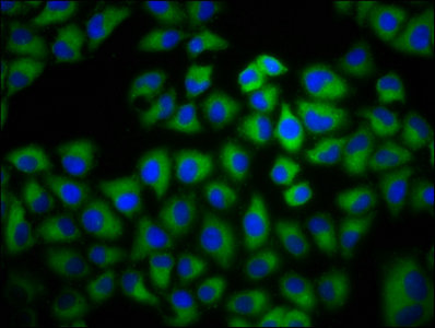 Immunofluorescence staining of Hela cells with ADCY6 Antibody at 1:133, counter-stained with DAPI. The cells were fixed in 4% formaldehyde, permeabilized using 0.2% Triton X-100 and blocked in 10% normal Goat Serum. The cells were then incubated with the antibody overnight at 4°C. The secondary antibody was Alexa Fluor 488-congugated AffiniPure Goat Anti-Rabbit IgG(H+L).Rabbit anti-Human ADCY6 Polyclonal Antibody