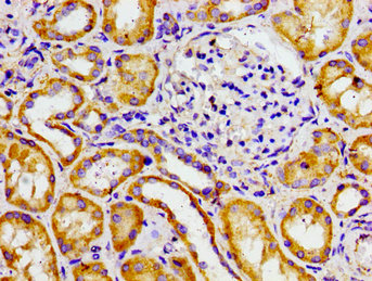 Immunohistochemistry of paraffin-embedded human kidney tissue using the antibody at dilution of 1:100