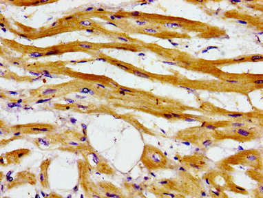 Immunohistochemistry of paraffin-embedded human heart tissue using ADCY6 Antibody at dilution of 1:100Rabbit anti-Human ADCY6 Polyclonal Antibody