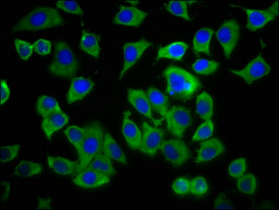 Immunofluorescence staining of A549 cells with ADCY8 Antibody at 1:233, counter-stained with DAPI. The cells were fixed in 4% formaldehyde, permeabilized using 0.2% Triton X-100 and blocked in 10% normal Goat Serum. The cells were then incubated with the antibody overnight at 4°C. The secondary antibody was Alexa Fluor 488-congugated AffiniPure Goat Anti-Rabbit IgG(H+L).Rabbit anti-Human ADCY8 Polyclonal Antibody