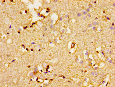 Immunohistochemistry of paraffin-embedded human brain tissue using the antibody at dilution of 1:100Rabbit anti-Human ADCY8 Polyclonal Antibody
