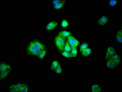 Immunofluorescence staining of HepG2 cells with ADH1A Antibody at 1:66, counter-stained with DAPI. The cells were fixed in 4% formaldehyde, permeabilized using 0.2% Triton X-100 and blocked in 10% normal Goat Serum. The cells were then incubated with the antibody overnight at 4°C. The secondary antibody was Alexa Fluor 488-congugated AffiniPure Goat Anti-Rabbit IgG(H+L).Rabbit anti-Human ADH1A Polyclonal Antibody
