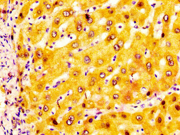 IHC image of the antibody diluted at 1:200 and staining in paraffin-embedded human liver tissue performed on a Leica BondTM system. After dewaxing and hydration, antigen retrieval was mediated by high pressure in a citrate buffer (pH 6.0). Section was blocked with 10% normal goat serum 30min at RT. Then primary antibody (1% BSA) was incubated at 4°C overnight. The primary is detected by a biotinylated secondary antibody and visualized using an HRP conjugated SP system.