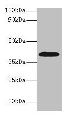 Western blot  | All lanes: ADH1B antibody at 2µg/ml + HepG2 whole cell lysate  | Secondary  | Goat polyclonal to rabbit IgG at 1/15000 dilution  | Predicted band size: 40, 36 kDa  | Observed band size: 40 kDaRabbit anti-Human ADH1B Polyclonal Antibody