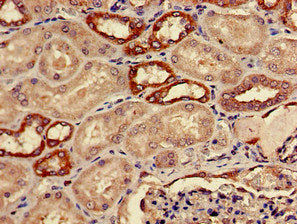 Immunohistochemistry of paraffin-embedded human kidney tissue using ADH5 Antibody at dilution of 1:100Rabbit anti-Human ADH5 Polyclonal Antibody