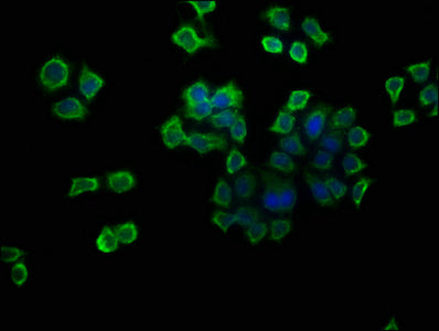 Immunofluorescence staining of PC-3 cells with ATP6V1G1 Antibody at 1:133, counter-stained with DAPI. The cells were fixed in 4% formaldehyde, permeabilized using 0.2% Triton X-100 and blocked in 10% normal Goat Serum. The cells were then incubated with the antibody overnight at 4°C. The secondary antibody was Alexa Fluor 488-congugated AffiniPure Goat Anti-Rabbit IgG(H+L).