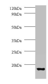 Western blot  | All lanes: V-type proton ATPase subunit G 1 antibody at 2μg/ml + 293T whole cell lysate  | Secondary  | Goat polyclonal to rabbit IgG at 1/15000 dilution  | Predicted band size: 14 kDa  | Observed band size: 14 kDa