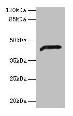 Western blot  | All lanes: ADH7 antibody at 2µg/ml + Mouse liver tissue  | Secondary  | Goat polyclonal to rabbit IgG at 1/10000 dilution  | Predicted band size: 42, 43 kDa  | Observed band size: 42 kDa