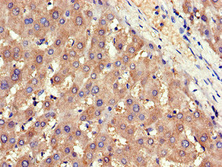 Immunohistochemistry of paraffin-embedded human liver tissue using ADIPOR1 Antibody at dilution of 1:100Rabbit anti-Human ADIPOR1 Polyclonal Antibody