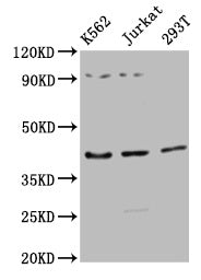 Western Blot  | Positive WB detected in: K562 whole cell lysate, Jurkat whole cell lysate, 293T whole cell lysate  | All lanes: ADIPOR1 antibody at 1:2500  | Secondary  | Goat polyclonal to rabbit IgG at 1/50000 dilution  | Predicted band size: 43 kDa  | Observed band size: 43 kDaRabbit anti-Human ADIPOR1 Polyclonal Antibody