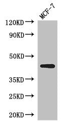 Western Blot  | Positive WB detected in: MCF-7 whole cell lysate  | All lanes: ADIPOR1 antibody at 2.5µg/ml  | Secondary  | Goat polyclonal to rabbit IgG at 1/50000 dilution  | Predicted band size: 43 kDa  | Observed band size: 43 kDa